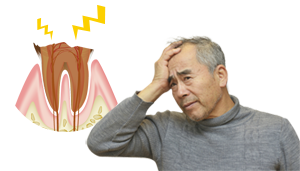 根管治療（歯の根の治療）について