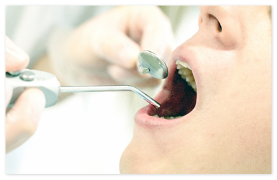 ただ歯科クリニックの虫歯治療について